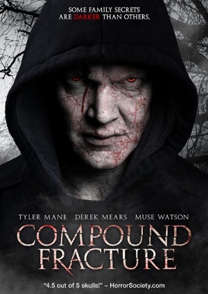 Смотреть Открытый перелом / Compound Fracture HDRip 2013 /  онлайн